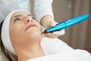 cryotherapy poulton blackpool preston