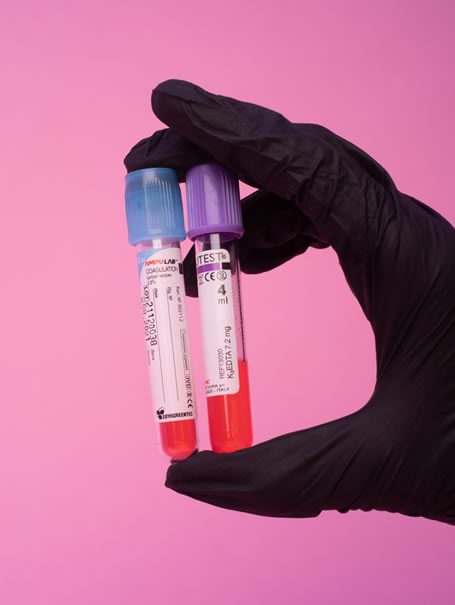 phlebotomy service poulton le fylde