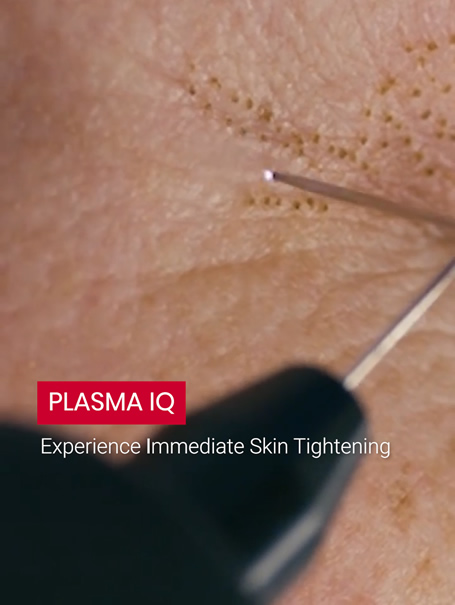 eyelid tightening poulton