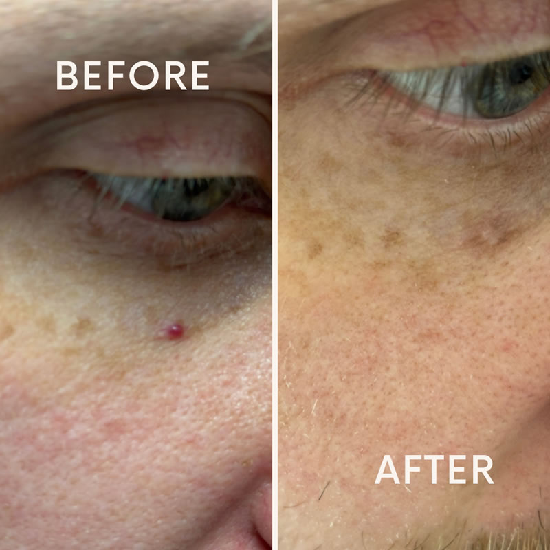 Before after minimal skincare