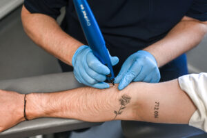 cryotherapy poulton le fylde